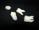Зубы человека: строение, названия, анатомия